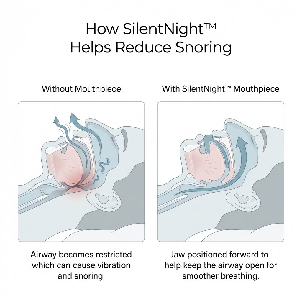 Trusalo SilentNight™ Mouthpiece