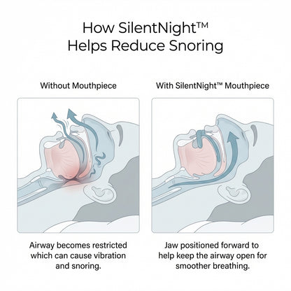 Trusalo SilentNight™ Mouthpiece
